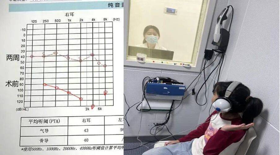基因治疗让盲人看到红外线(基因治疗失明)